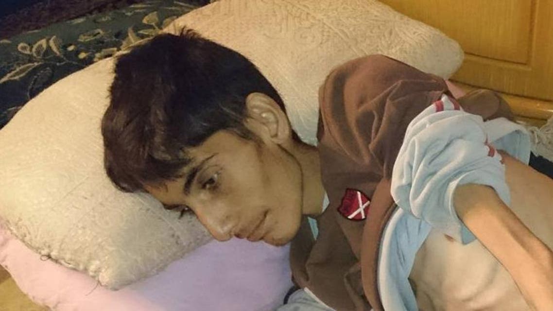 محمد شعبان مات جوعاً في مضايا