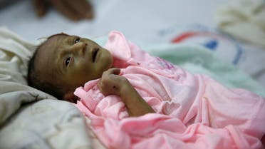 In this Jan. 24, 2016 photo, a malnourished child lies in a bed at a therapeutic feeding center in a hospital in Sanaa, Yemen. Some 3 million children here under five years require services to treat or prevent malnutrition, according to a UNICEF report on Jan. 13. (AP)