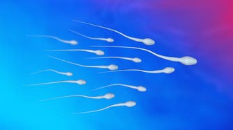 Spanish scientists use skin cells to create human sperm