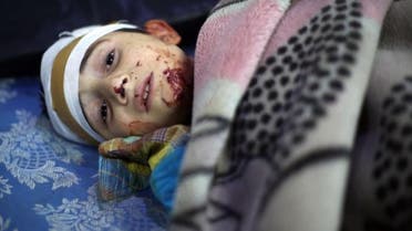 A wounded Syrian boy looks on at a makeshift hospital, following reported Syrian government air strikes on the rebel-held town of Arbin in the eastern Ghouta region on the outskirts of the capital Damascus, on May 9, 2016.  (AFP)