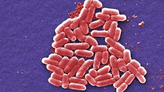 US sees first case of bacteria resistant to all antibiotics