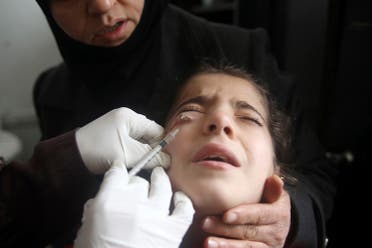 A doctor treats a child showing symptoms of leishmaniasis at a hospital in Aleppo, February 11, 2013. (Reuters)