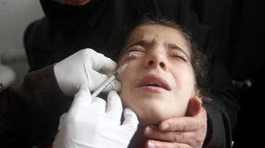 A doctor treats a child showing symptoms of leishmaniasis at a hospital in Aleppo, February 11, 2013. (AP)
