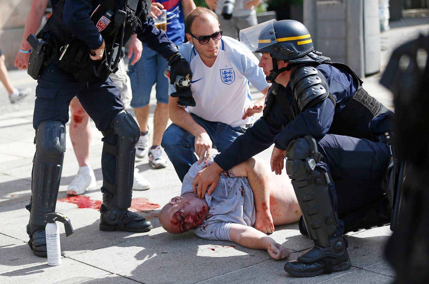 An man injured in clashes is assisted by police officers in downtown Marseille, France, Saturday, June 11, 2016. Riot police have thrown tear gas canisters at soccer fans Saturday in Marseille's Old Port in a third straight day of violence in the city. (AP)