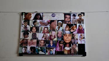 In this Saturday, May 19, 2012 photo, a board showing pictures of acid attack survivors is placed on a wall inside the Acid Survivors Foundation (ASF), in Islamabad, Pakistan.