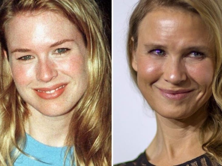 Is Renee Zellweger Forbidden To Age Al Arabiya English