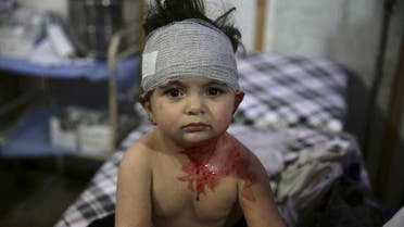 An injured child sits inside a field hospital, after what activists said was shelling by forces loyal to Syria's President Bashar al-Assad, in the Douma neighborhood of Damascus, Syria. REUTERS/Bassam Khabieh