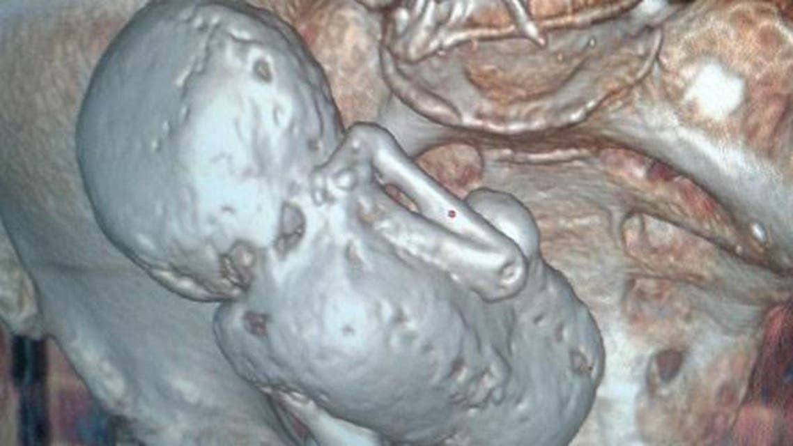 the fetus in the womb of the old lady
