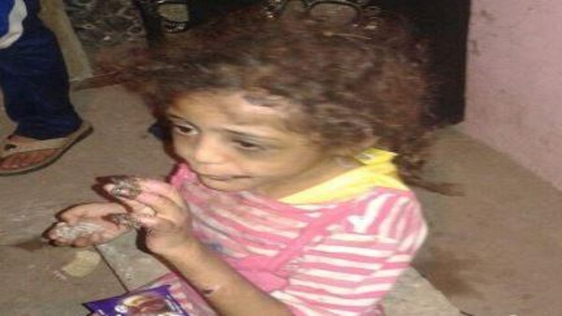 مصري يعذب طفلته حرقاً.. والسبب صادم