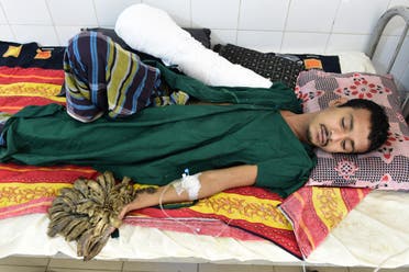 Bangladeshi man Abdul Bajander rests a day after a surgery at Dhaka Medical College Hospital in Dhaka on February 21, 2016. A Bangladeshi man dubbed ‘tree man’ due to large bark-like warts growing on his hands and feet underwent successful surgery on February 20 to remove some of the growths. AFP PHOTO/ Munir uz ZAMAN MUNIR UZ ZAMAN / AFP