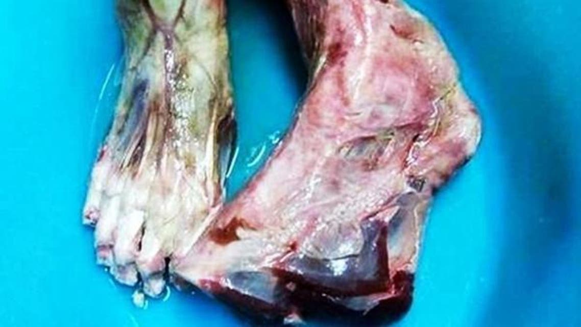 انسانی گوشت