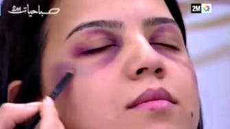 TV channel showing makeup for battered women gets punished 