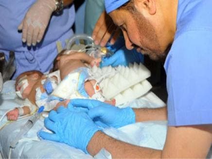 saudi dr twins