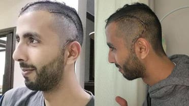 PHOTOS: What happened to the Saudi student attacked in the US? | Al Arabiya English PHOTOS: What happened to the Saudi student attacked in the US? | Al Arabiya English