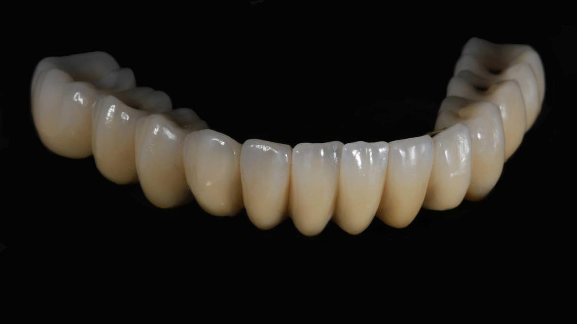 The finished product after Middle East Dental Lab applied ceramic