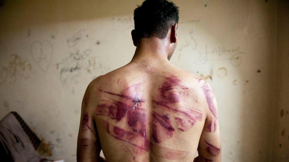 Syrian man shows marks of tortue on his back after he was released from prison in 2012. (AFP)