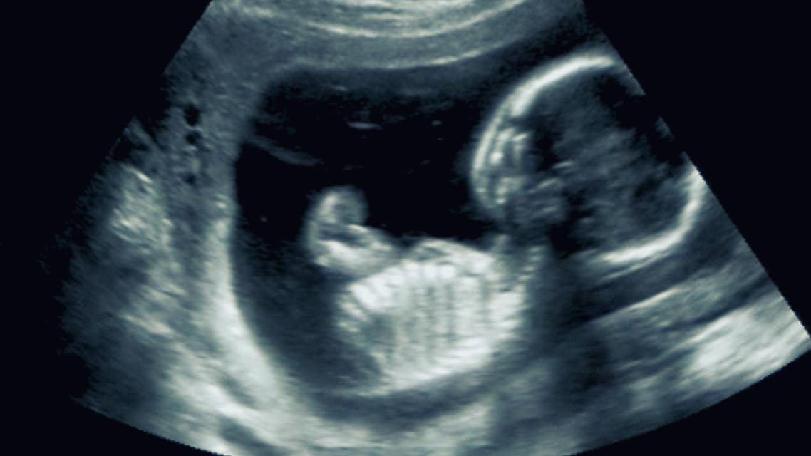 embryo shutterstock