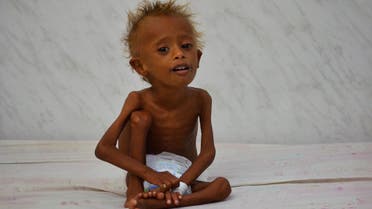 Salem Abdullah Musabih, 6, sits on a bed at a malnutrition intensive care unit at a hospital in the Red Sea port city of Hodaida, Yemen September 11, 2016. REUTERS/Abduljabbar Zeyad SEARCH "FAMINE YEMEN" FOR THIS STORY. SEARCH "WIDER IMAGE" FOR ALL STORIES.
