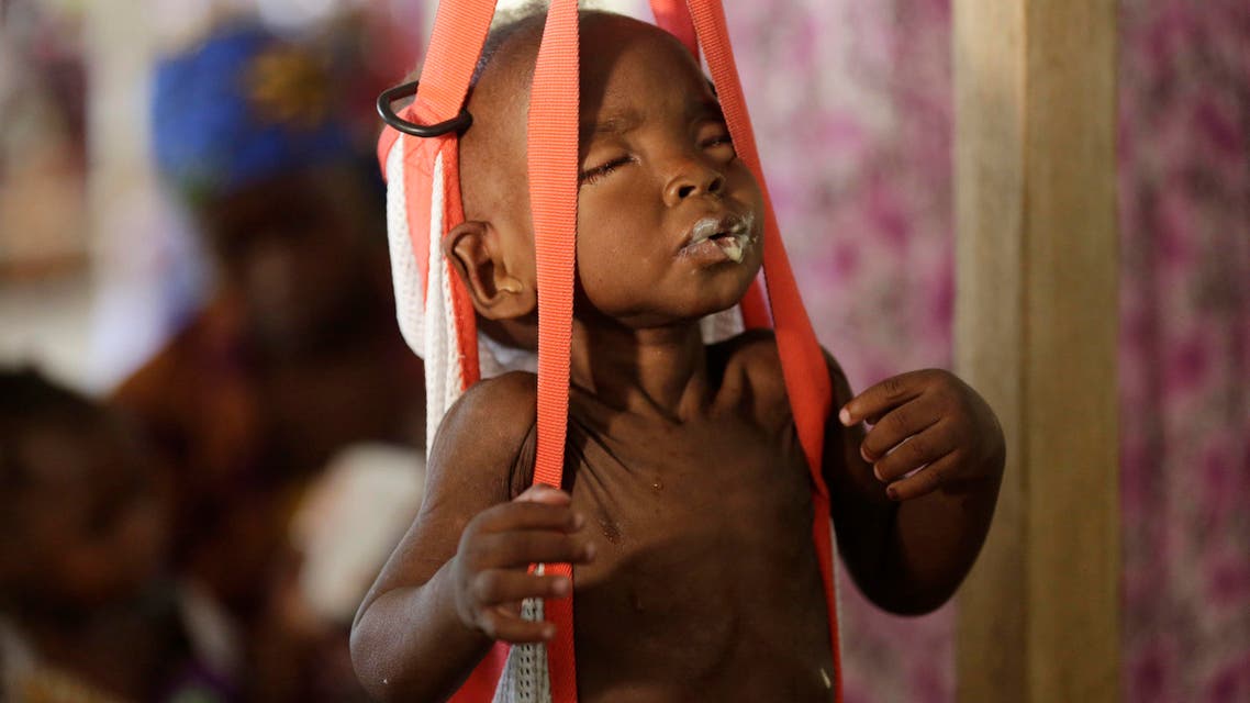 In this Monday, Aug. 29, 2016 file photo, a malnourished child is weighed on a scales at a clinic run by Doctors Without Borders in Maiduguri, Nigeria. AP