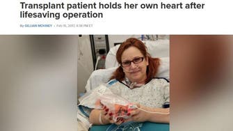Woman holds her own heart in hands after life-saving surgery