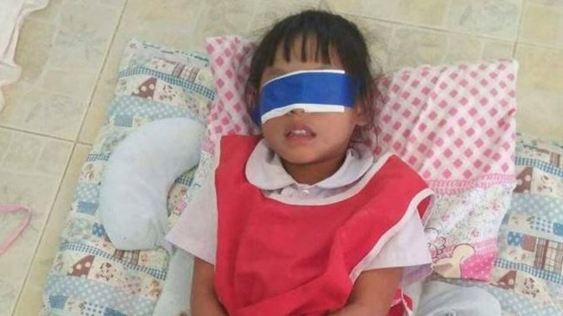 عصبا عيني طفلة في مدرسة