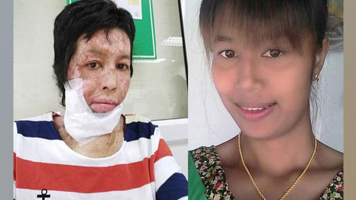 يحرق زوجته بعد أن نشرت صورا "سيلفي" على الفيسبوك