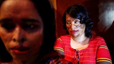 Acid attack survivors wait in the back stage prior to participate in a fashion show titled “Beauty Redefined” organized by ActionAid Bangladesh in Dhaka, Bangladesh, March 7, 2017. Picture taken March 7, 2017. REUTERS/ Mohammad Ponir Hossain TPX IMAGES OF THE DAY TPX IMAGES OF THE DAY