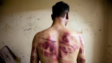 A Syrian man shows marks of torture on his back, after he was released from regime forces, in the Bustan Pasha neighbourhood of Syria's northern city of Aleppo on August 23, 2012. AFP