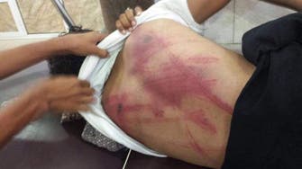 Yemeni student in Aden gets detained, tortured with electric wires