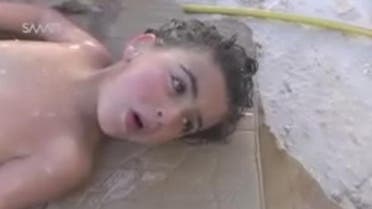 kid suffering syria chemical
