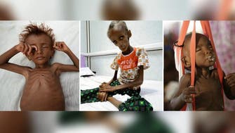 ‘Mass’ starvation deaths threaten Africa, Yemen