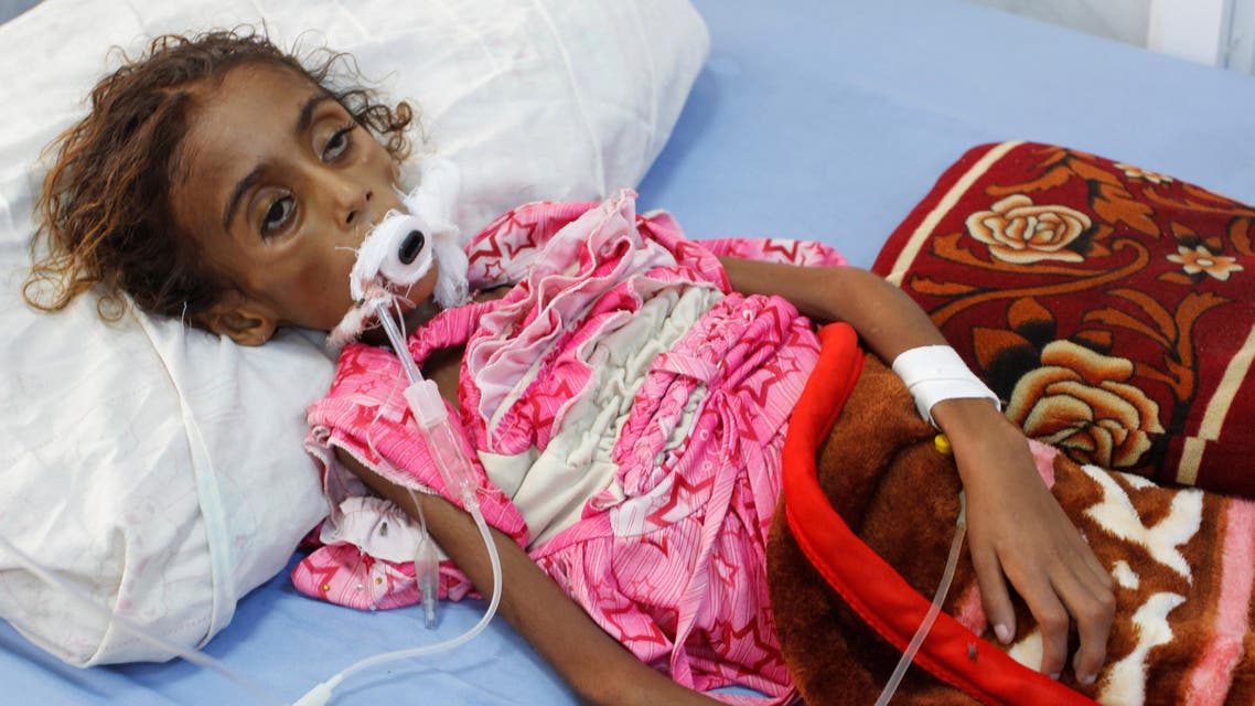 Malnourished girl Jamila Ali Abdu, 7, lies on a hospital bed before she died in the Red Sea port city of Hodeidah, Yemen May 2, 2017. (Reuters)