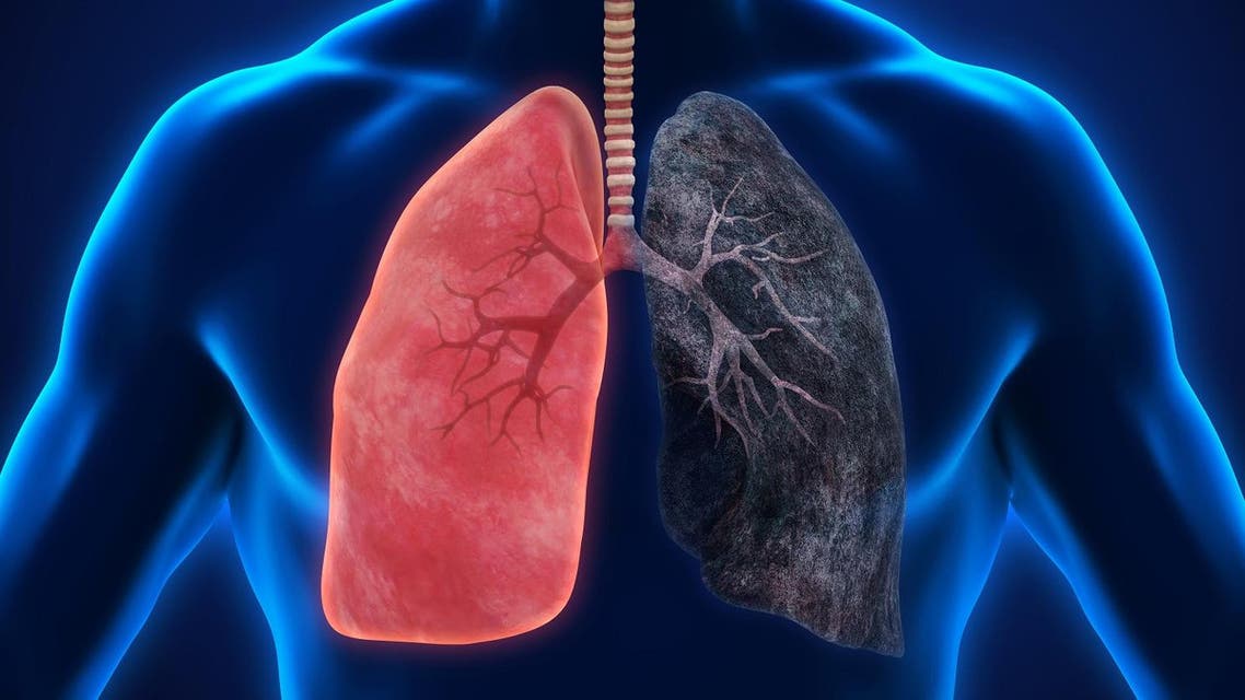 ealthy Lung and Smokers Lung. 3D rendering. (Shutterstock)