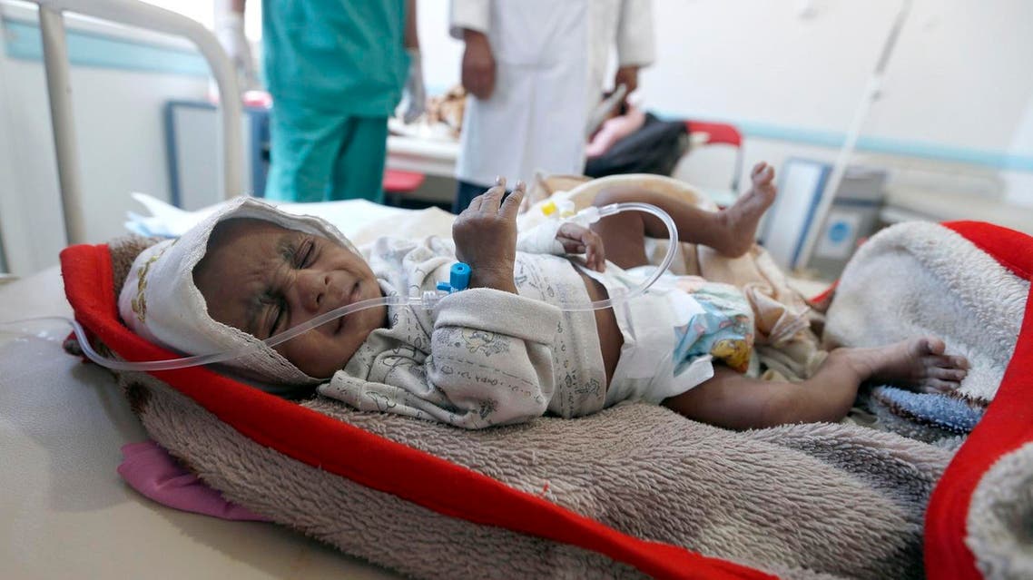 A Yemeni child suspected of being infected with cholera receives treatment at a hospital in Sanaa on May 25, 2017. Cholera has killed 315 people in Yemen in under a month, the World Health Organization has said, as another aid organisation warned Monday the outbreak could become a "full-blown epidemic".