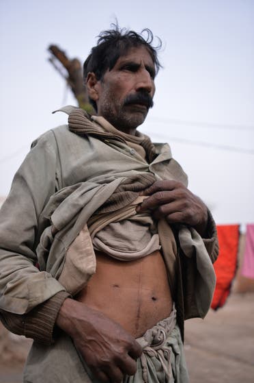 Pakistan: Illegal Kidney trading (AFP, Feb, 2017)