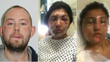 an acid attack in east London last week that left an aspiring model and her cousin with life-changing injuries and is now being treated as a hate crime.