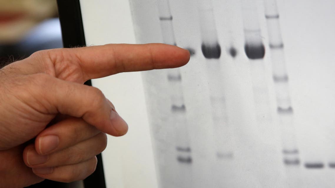 Scientists revealed the atomic structure of the tau protein filaments and say it should help develop new treatments for Alzheimer’s disease.