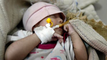A Yemeni infant suspected of being infected with cholera receives treatment at Sabaeen Hospital in Sanaa. (AFP) 