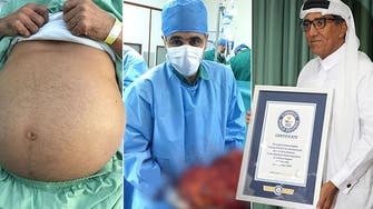 Dubai hospital receives Guinness award for removing world’s largest kidneys 