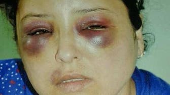 Egyptian woman brutally assaulted for refusing free cigarettes