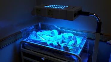 Babies under phototherapy lamp to prevent jaundice, MSF maternity unit in Kabul, Afghanistan.  