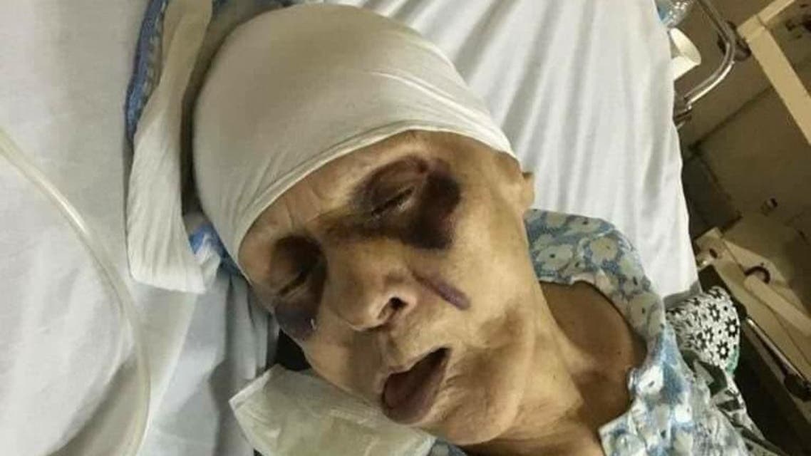 مأساة مسنة مصرية عذبها ابنها إرضاء لزوجته