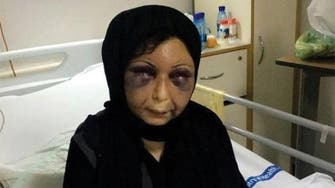 صور مؤلمة جديدة للسورية "زهراء" بعد خروجها من المستشفى
