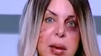 WATCH: Why did this Egyptian host present her TV show with a battered face?