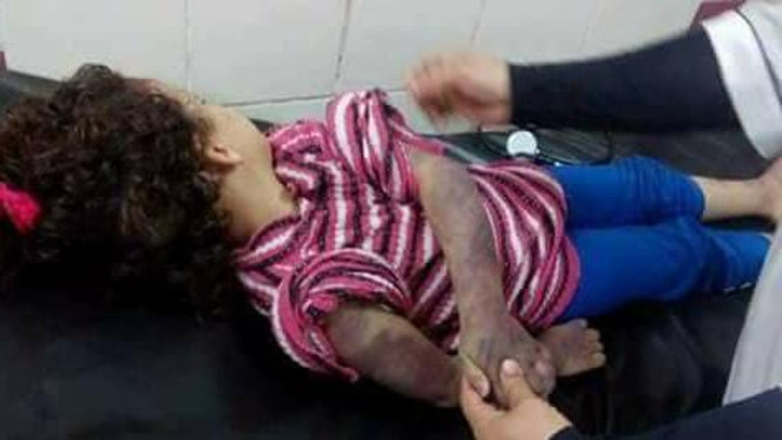 تعذيب طفلة مصرية حتى الموت