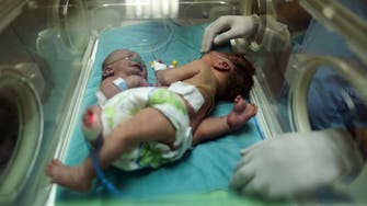 Saudi Crown Prince: Conjoined twins to be treated in Riyadh