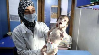 Shocking photos of Syrian baby who died of hunger under Assad regime siege 