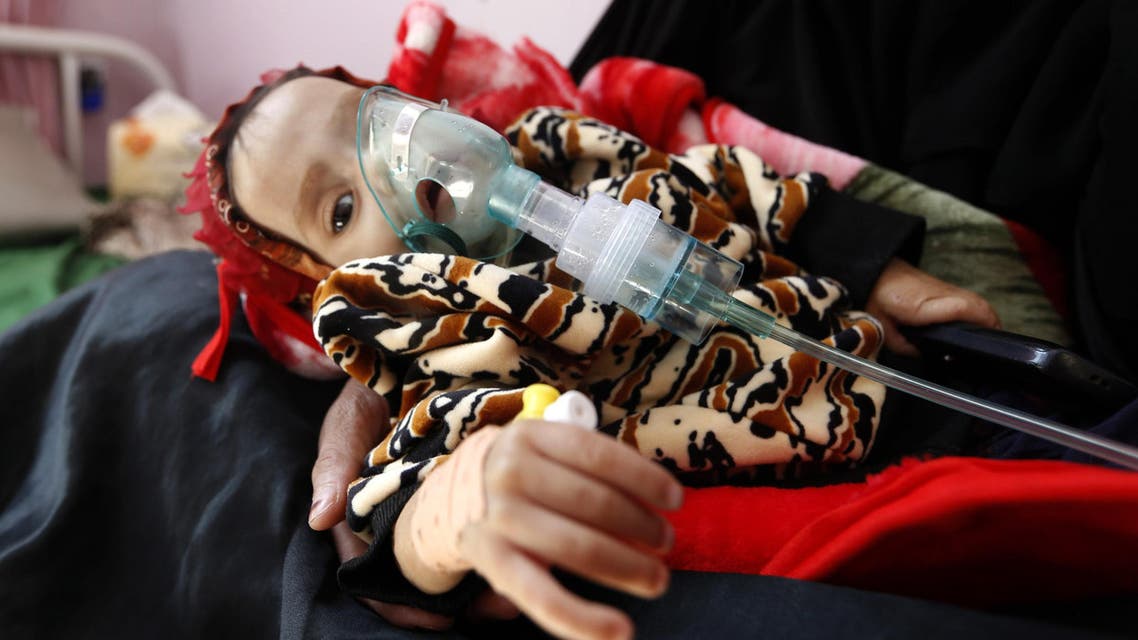 A malnourished Yemeni child receives treatment at a hospital in the capital Sanaa on November 22, 2017. afp