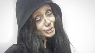 In bid to look like Angelina Jolie, Iranian woman looks more like ‘Corpse Bride’