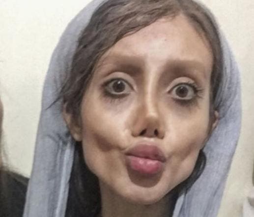 After more than 50 surgeries, Sahar now looks like the  ‘Corpse Bride’ character. (Supplied)